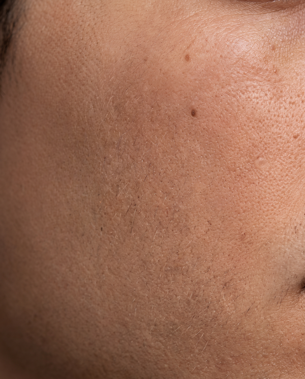 Extreme macro close-up of skin along the jawline showing sparse, fine facial hair growth