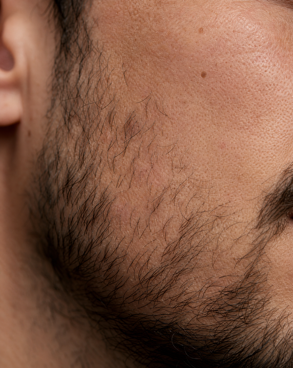 The Ingredient Behind Fuller Beard Growth, Explained